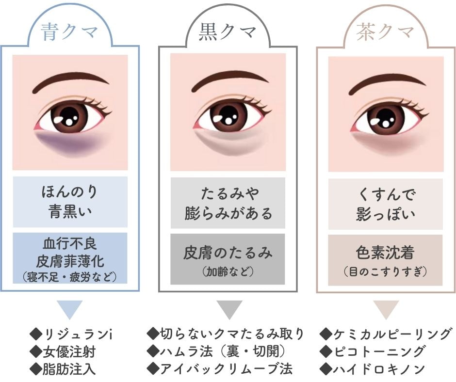 まずはセルフチェック☑️